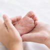 Trẻ dị ứng đạm sữa bò thì cha mẹ nên làm gì?