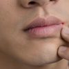 Các thay đổi trên mặt tưởng có thể cảnh báo bệnh nguy hiểm